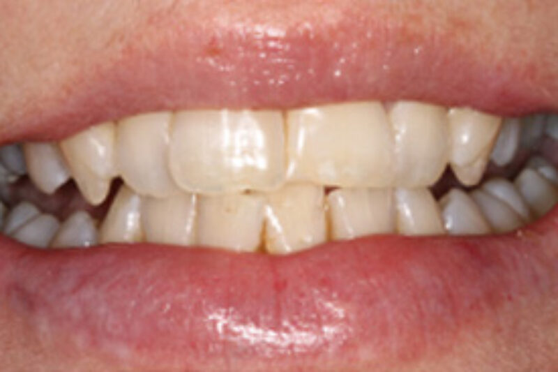 Before - Cheadle Hulme Dental