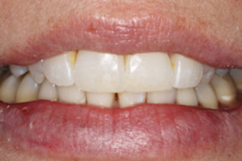 After - Cheadle Hulme Dental