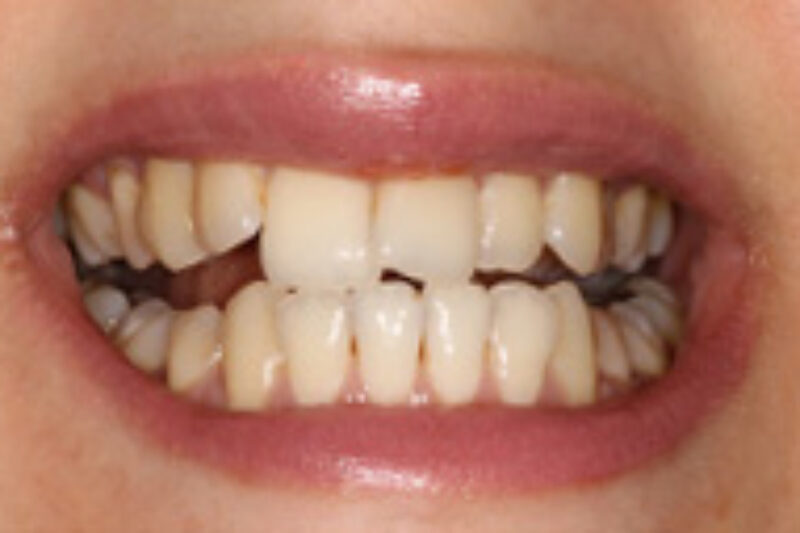 Before - Cheadle Hulme Dental