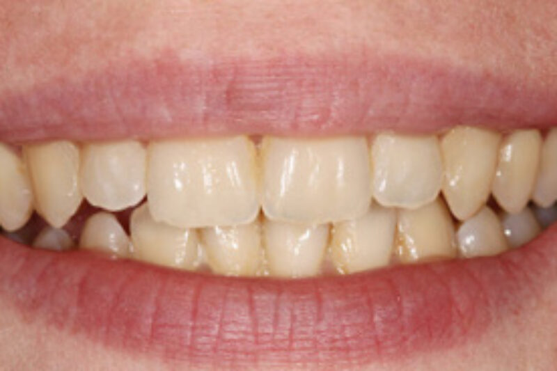 After - Cheadle Hulme Dental