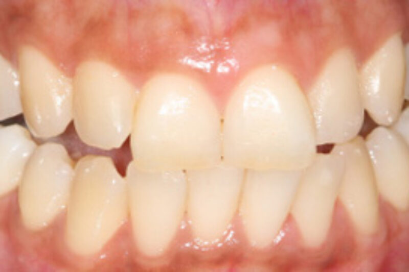 Before - Cheadle Hulme Dental