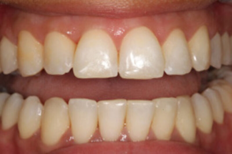 After - Cheadle Hulme Dental