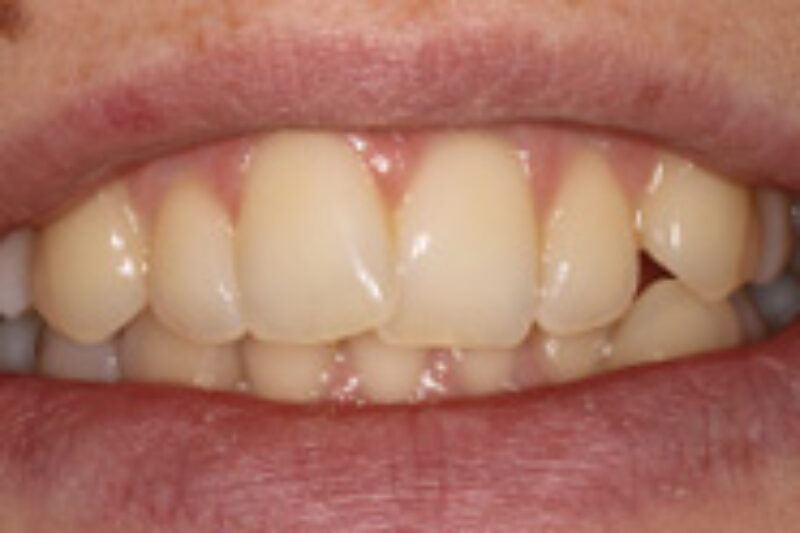 Before - Cheadle Hulme Dental