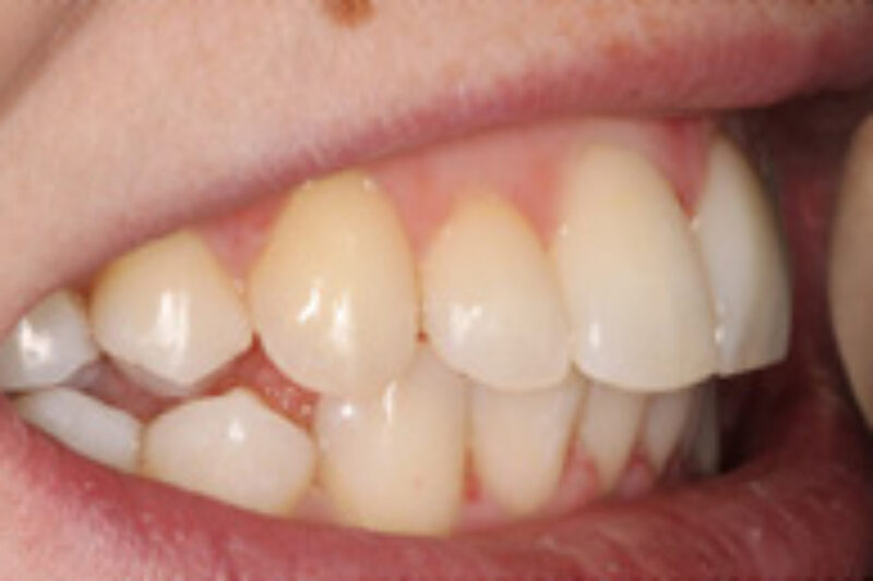 After - Cheadle Hulme Dental