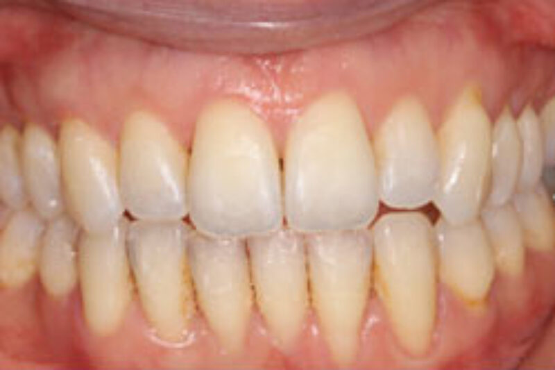 After - Cheadle Hulme Dental