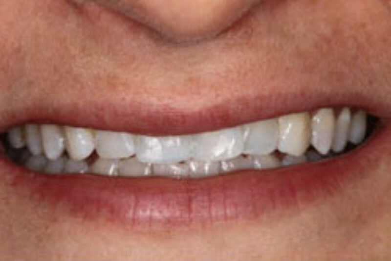 After - Cheadle Hulme Dental