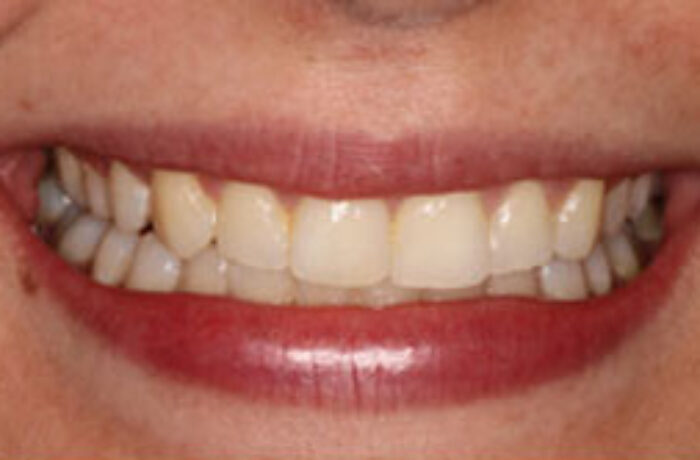 After - Cheadle Hulme Dental