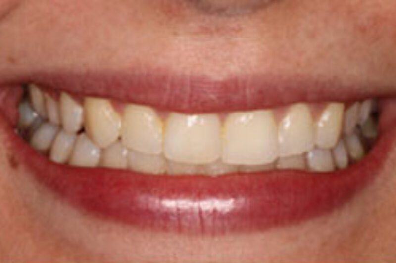 After - Cheadle Hulme Dental