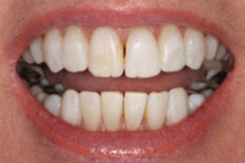 After - Cheadle Hulme Dental