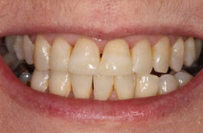 After - Cheadle Hulme Dental