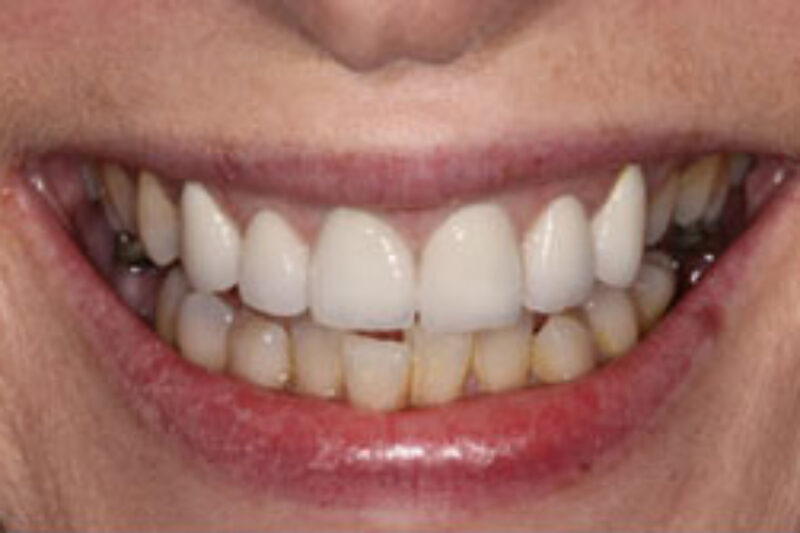 After - Cheadle Hulme Dental