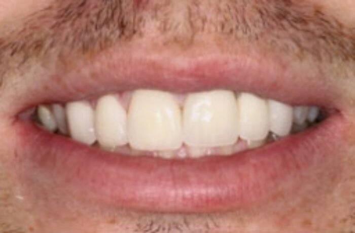 After - Cheadle Hulme Dental