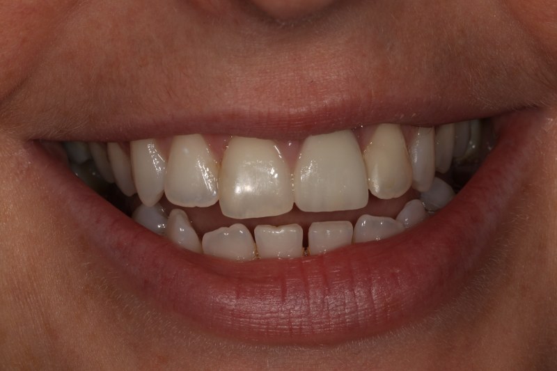 After - Cheadle Hulme Dental