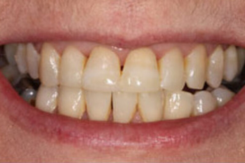 After - Cheadle Hulme Dental