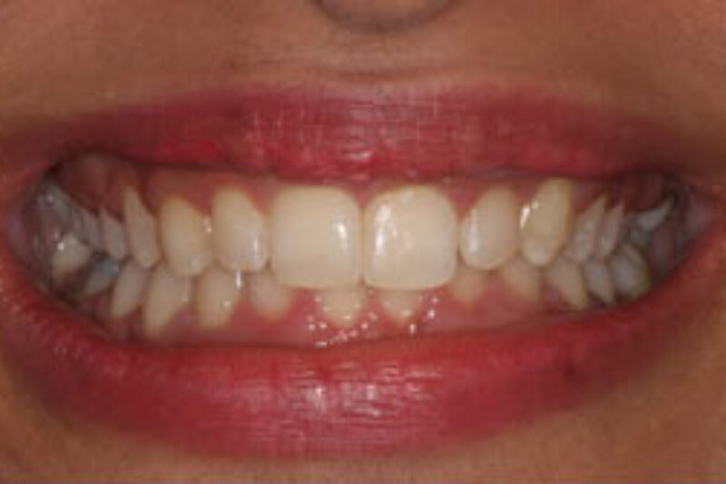 After - Cheadle Hulme Dental