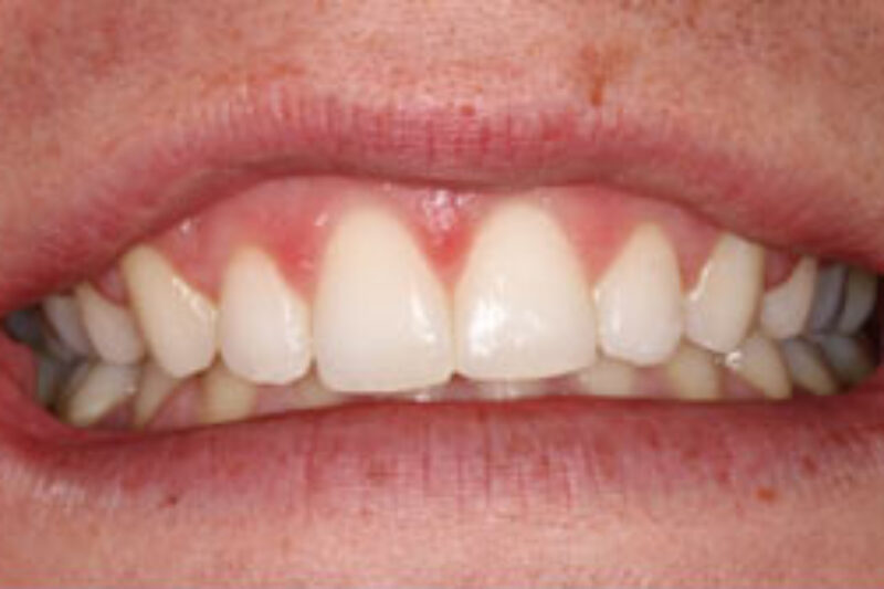 After - Cheadle Hulme Dental