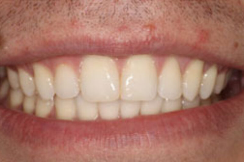 After - Cheadle Hulme Dental