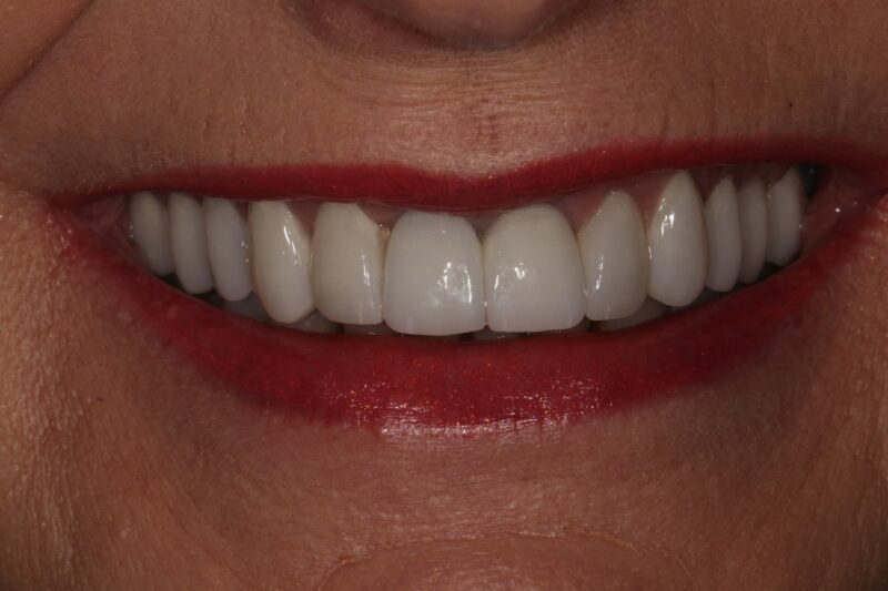 After - Cheadle Hulme Dental