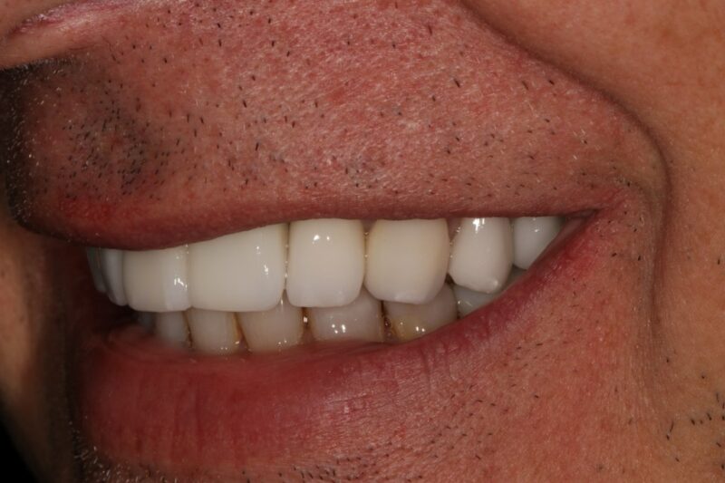 After - Cheadle Hulme Dental