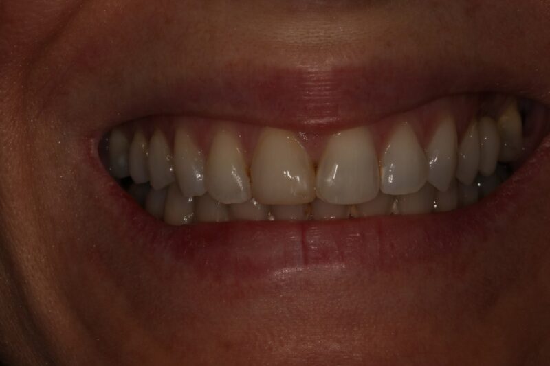 After - Cheadle Hulme Dental