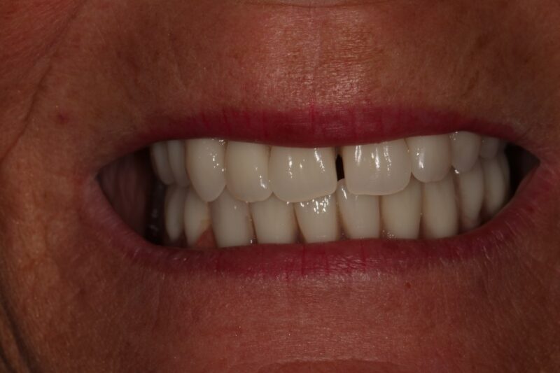 After - Cheadle Hulme Dental