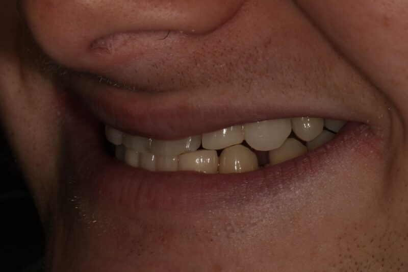 After - Cheadle Hulme Dental