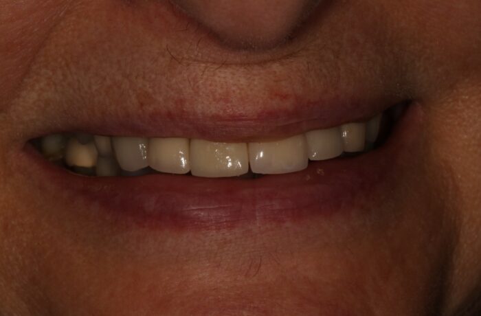 After - Cheadle Hulme Dental