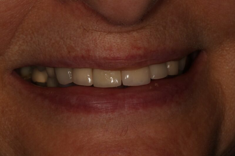 After - Cheadle Hulme Dental