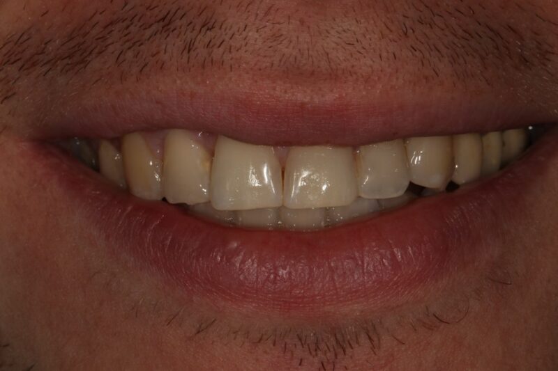 After - Cheadle Hulme Dental