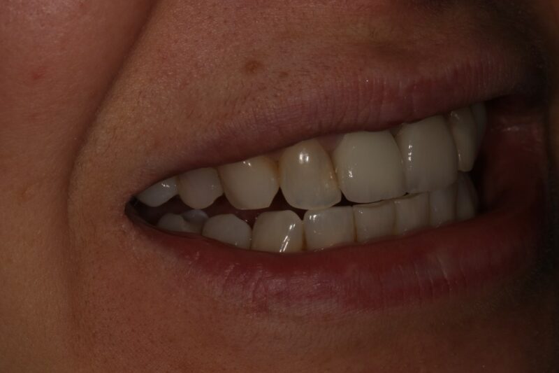 After - Cheadle Hulme Dental