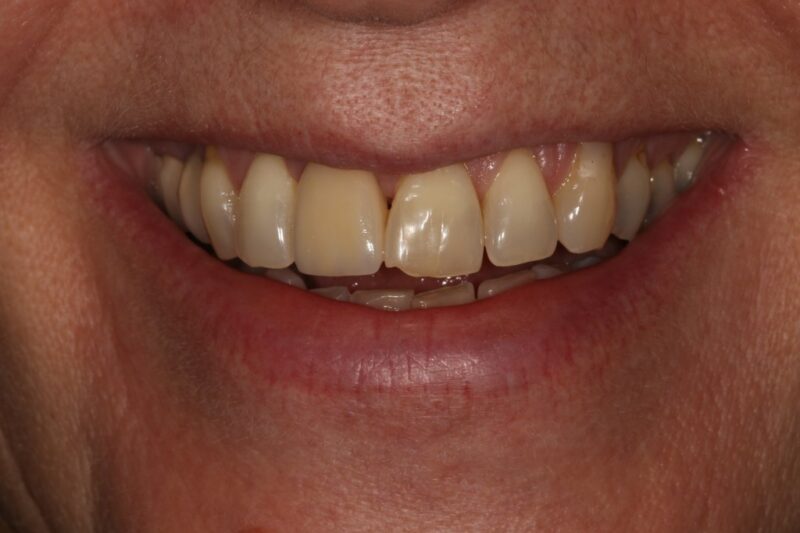 After - Cheadle Hulme Dental