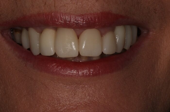 After - Cheadle Hulme Dental