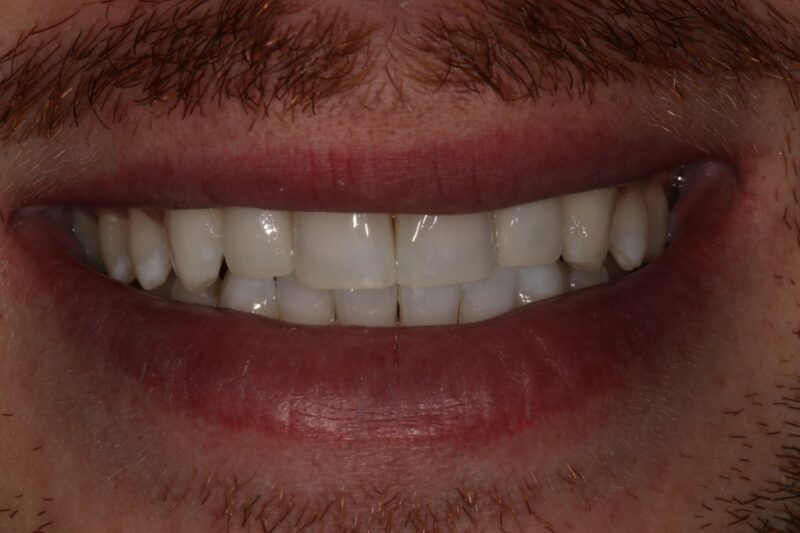 After - Cheadle Hulme Dental