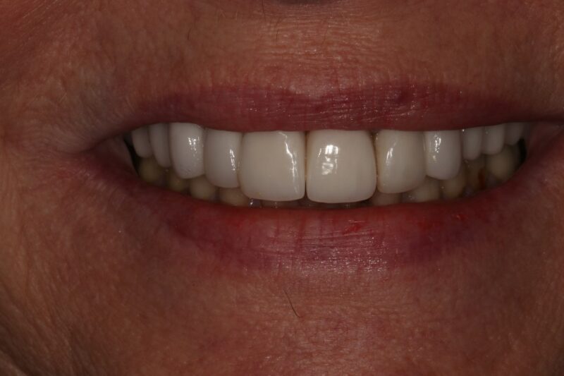 After - Cheadle Hulme Dental