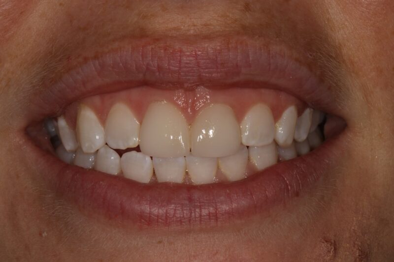 After - Cheadle Hulme Dental