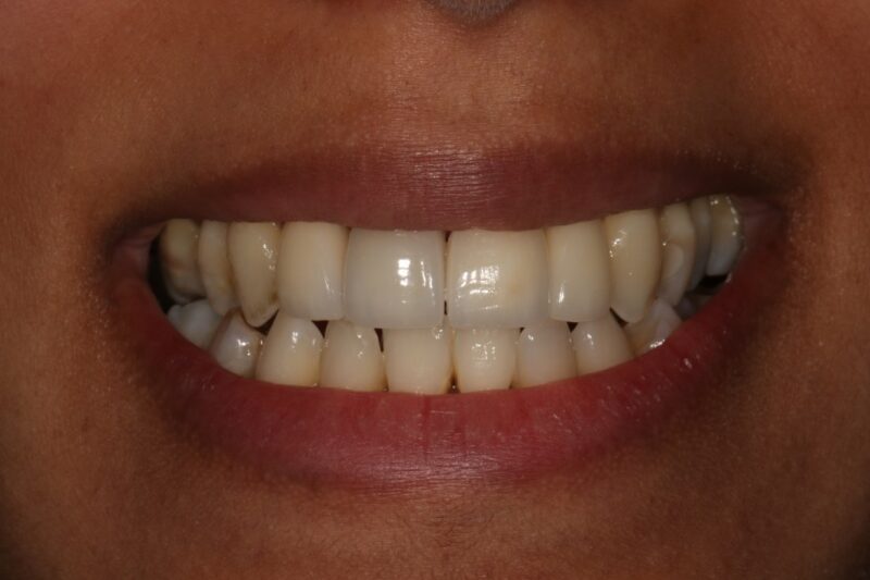 After - Cheadle Hulme Dental