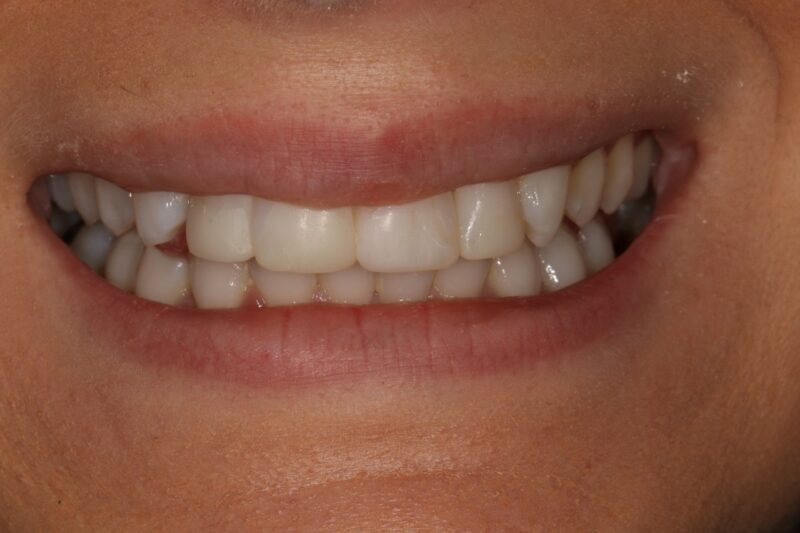 After - Cheadle Hulme Dental