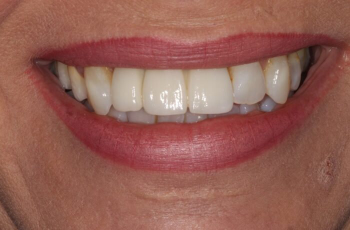 After - Cheadle Hulme Dental