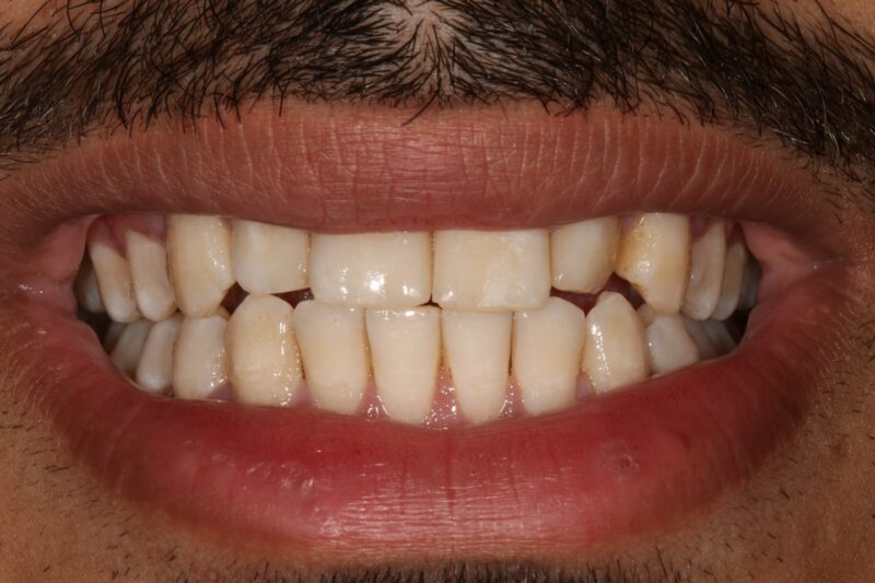 After - Cheadle Hulme Dental