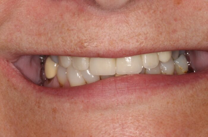 After - Cheadle Hulme Dental