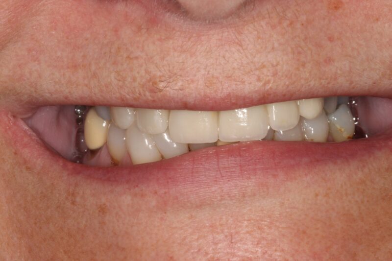 After - Cheadle Hulme Dental