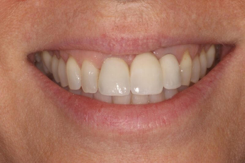 After - Cheadle Hulme Dental