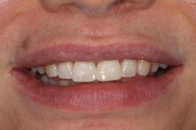 After - Cheadle Hulme Dental