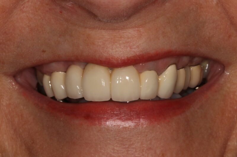 After - Cheadle Hulme Dental