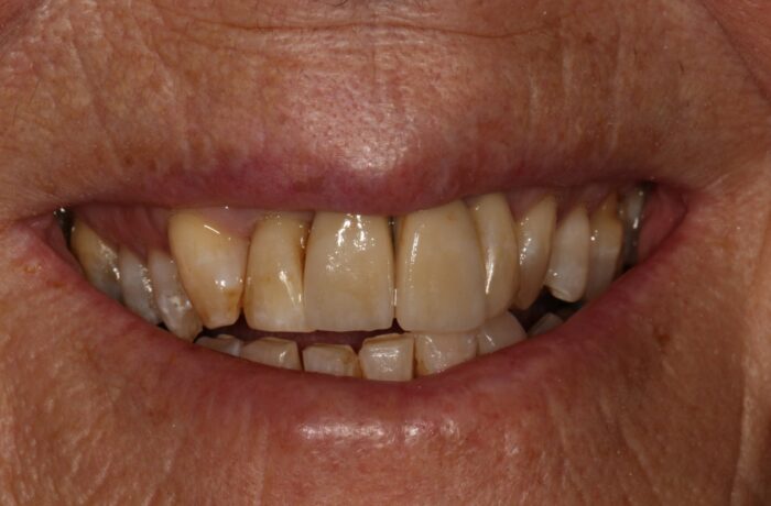 After - Cheadle Hulme Dental