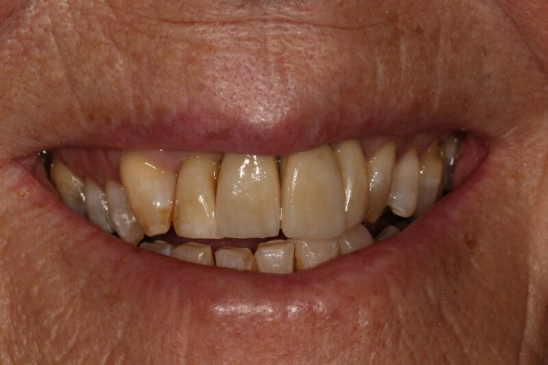 After - Cheadle Hulme Dental