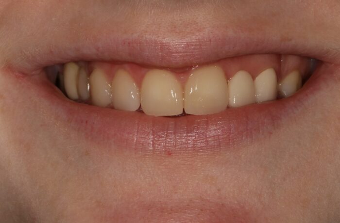 Before - Cheadle Hulme Dental