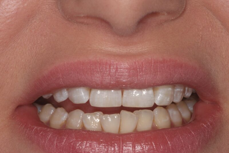 After - Cheadle Hulme Dental