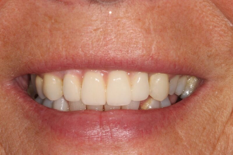 After - Cheadle Hulme Dental