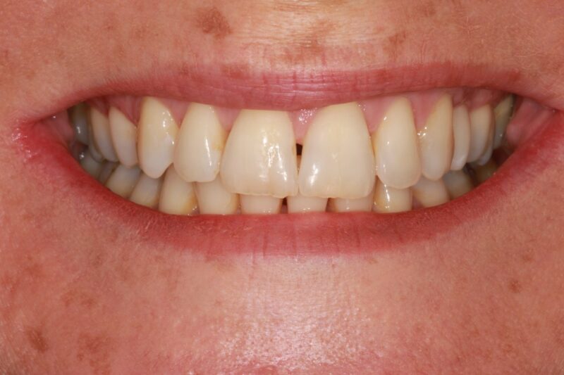 After - Cheadle Hulme Dental